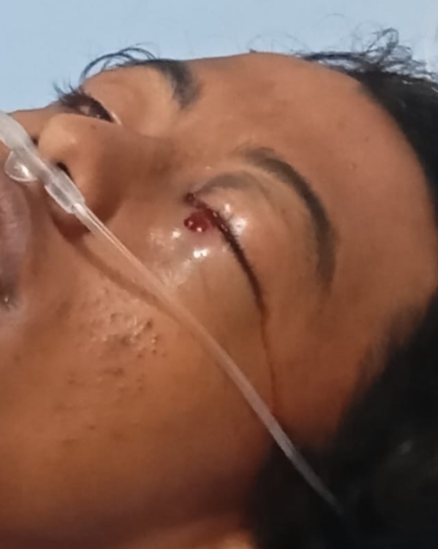 Remaja Tunarungu di Tangerang Tertembak di Mata, Keluarga Desak Polisi Usut Tuntas* 9 1742865381868
