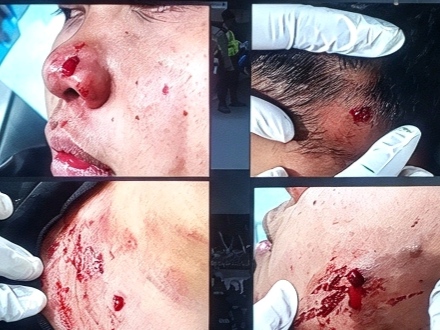 Gerak Cepat Polres Boyolali, Pelaku Penembakan Tukang Tambal Ban Berhasil Ditangkap dalam 2 x 24 Jam. 5 IMG 20261014 184359